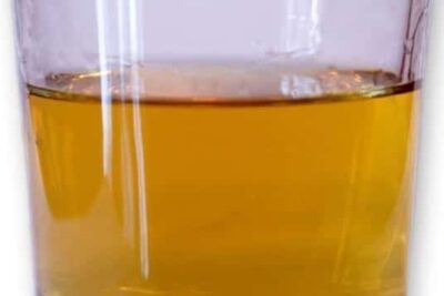 Adicciones. Alcoholismo y otros