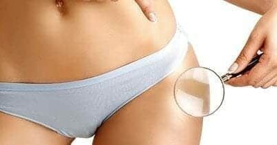 8 Pasos para acabar con la celulitis