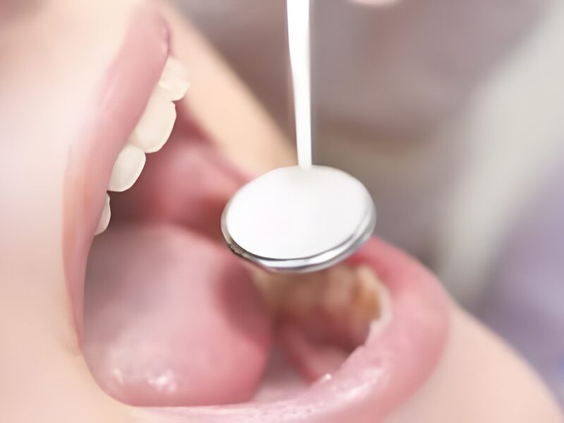 La higiene bucodental favorece la salud de personas diabéticas