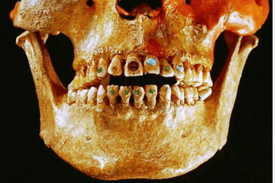 Breve repaso a la historia de la Odontología con la Clínica Dental Urbina en Salamanca