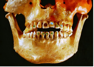 Breve repaso a la historia de la Odontología con la Clínica Dental Urbina en Salamanca
