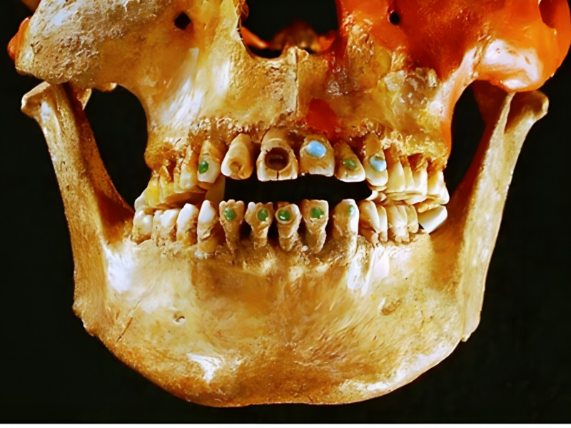 Breve repaso a la historia de la Odontología con la Clínica Dental Urbina en Salamanca