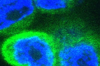 Immune surprise: recently evolved alarm molecule drives inflammation