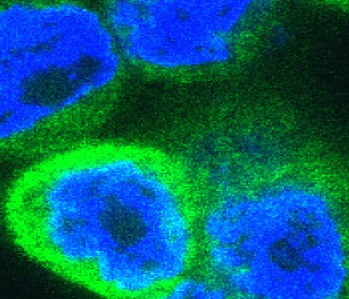 Immune surprise: recently evolved alarm molecule drives inflammation