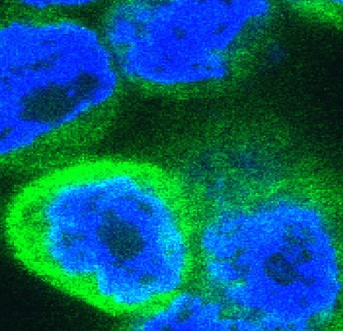 Immune surprise: recently evolved alarm molecule drives inflammation