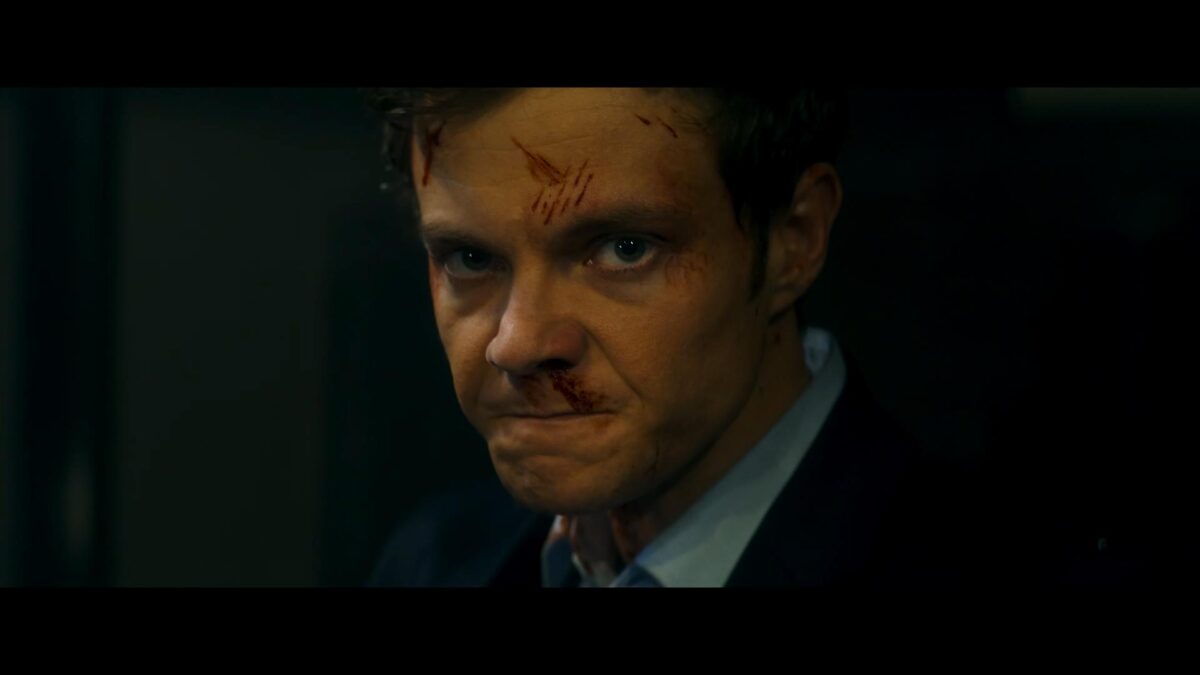 “Anh Không Đau”: Một bộ phim hài hước và điên cuồng