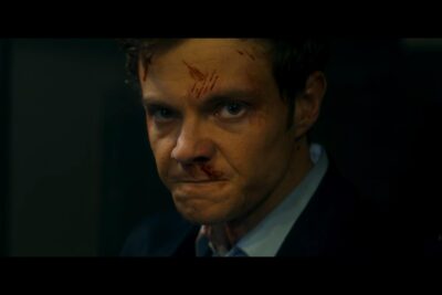 “Anh Không Đau”: Một bộ phim hài hước và điên cuồng