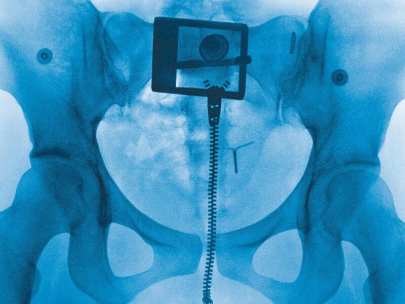 A revolução da página em branco: Lorde e a superestrela além da gravadora