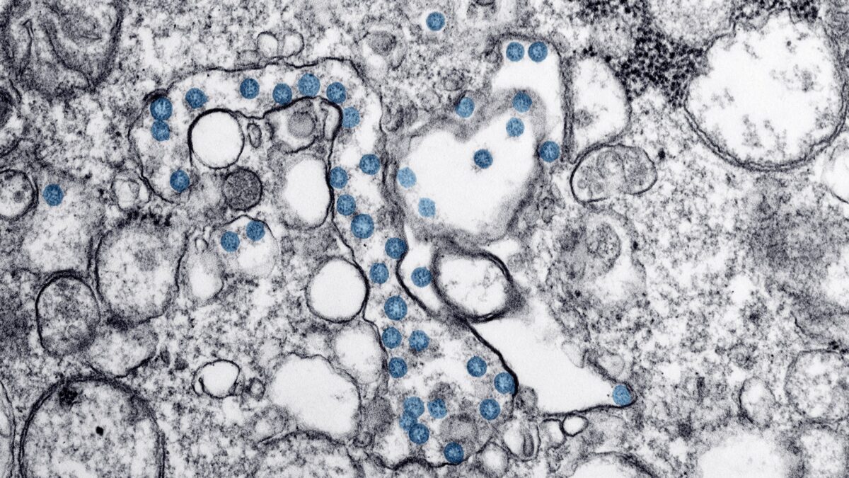 Dos momias en Chile guardan la primera prueba genética del origen europeo de la viruela