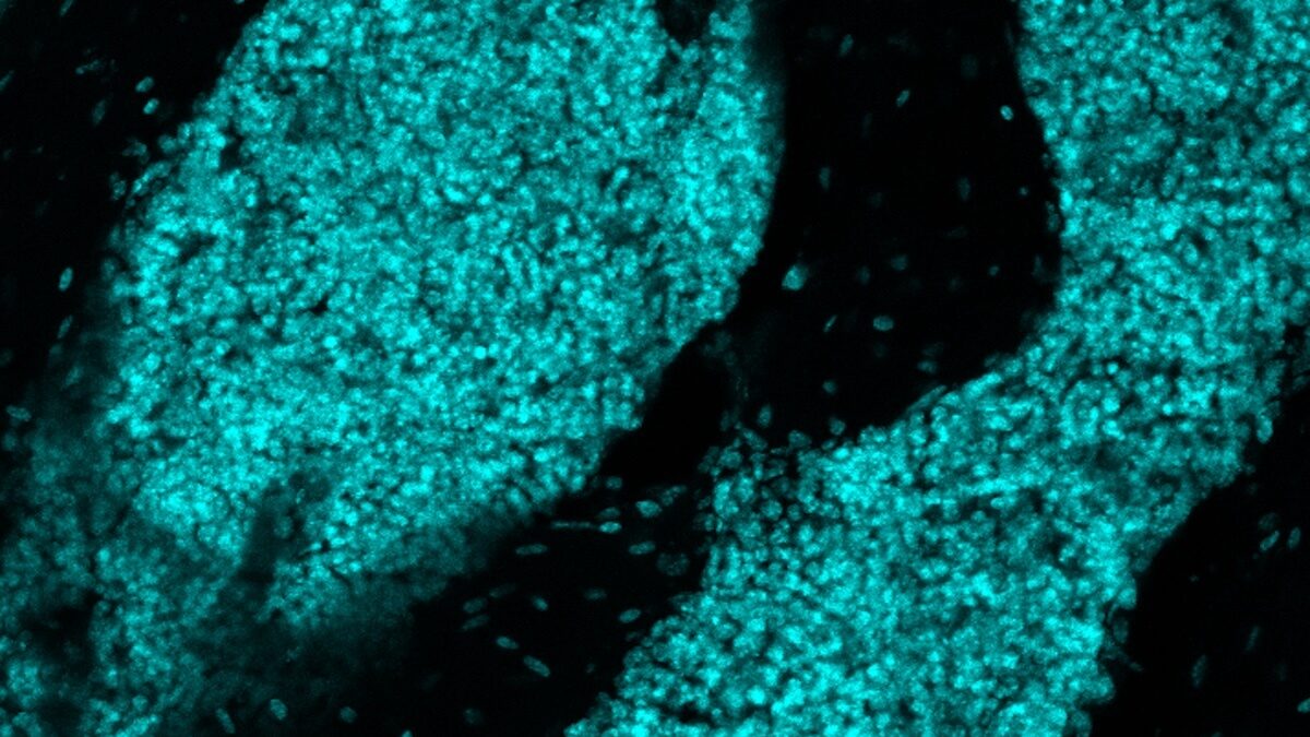 El cerebro estaba aislado de la inmunidad — pero su cráneo tenía otros planes