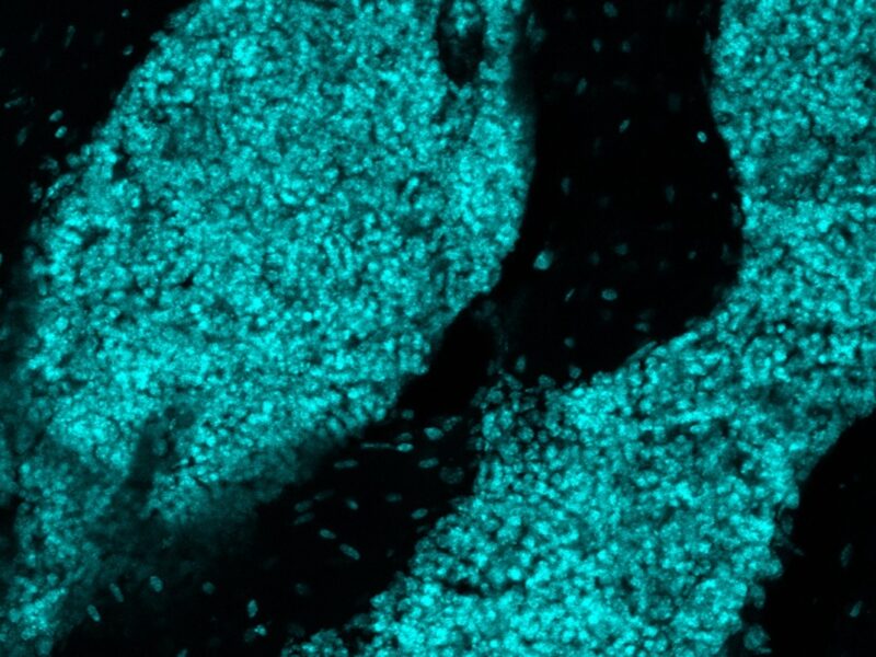 El cerebro estaba aislado del sistema inmune — pero su cráneo tenía otros planes