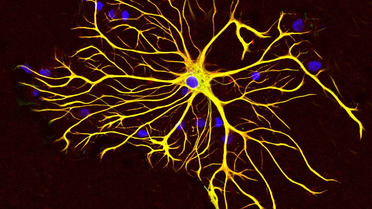 Las células de soporte del cerebro se creían insustituibles — el cerebro adulto las está reemplazando