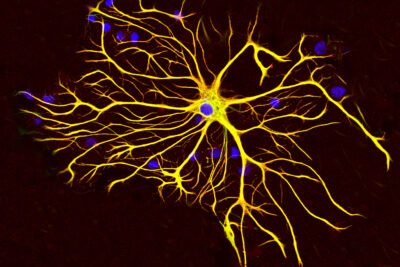 Fluorescence microscopy image of an astrocyte (star-shaped brain support cell) stained in green against a dark background