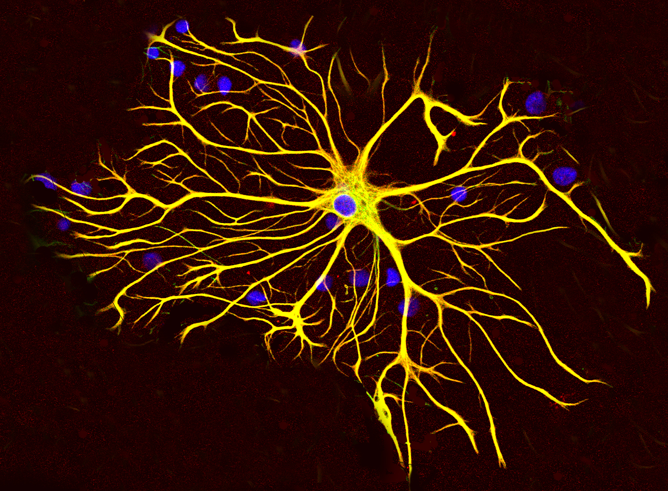 Las células de soporte del cerebro se creían insustituibles — el cerebro adulto las está sustituyendo