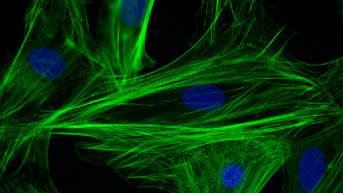 Heart muscle grows back after a heart attack — confirmed in humans for the first time