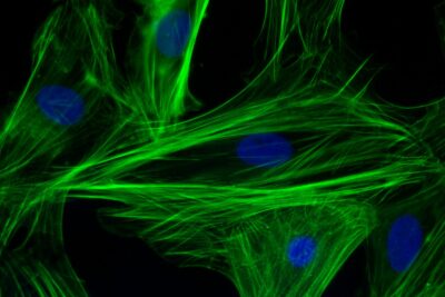 Fluorescence microscopy image of cardiomyocytes (heart muscle cells) showing F-actin protein filaments in green and cell nuclei in blue, against a dark background