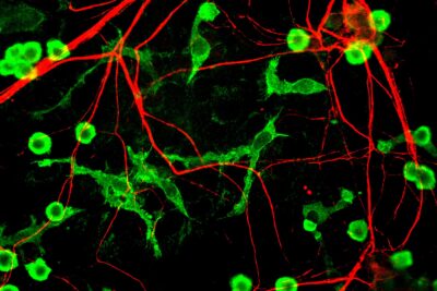 Fluorescence microscopy image of microglia cells (green) alongside neuronal axons (red) in rat brain cell culture