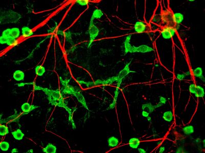 Fluorescence microscopy image of microglia cells (green) alongside neuronal axons (red) in rat brain cell culture