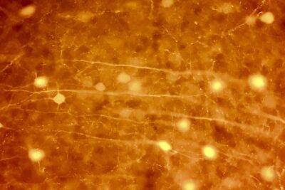 Fluorescent microscope image of cortical neurons glowing orange, with fine branching fibres between the cell bodies