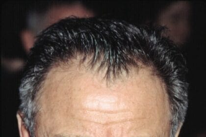 Harvey Keitel